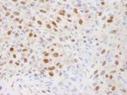 Detection of mouse EFTUD2/SNRP116 by immunohistochemistry.