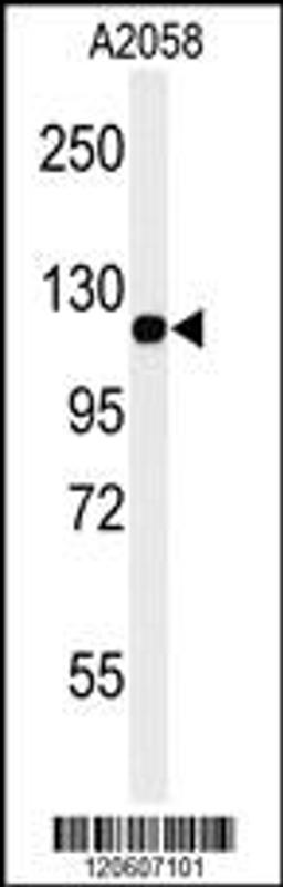 Western blot analysis of MCAM Antibody in A2058 cell line lysates (35ug/lane)