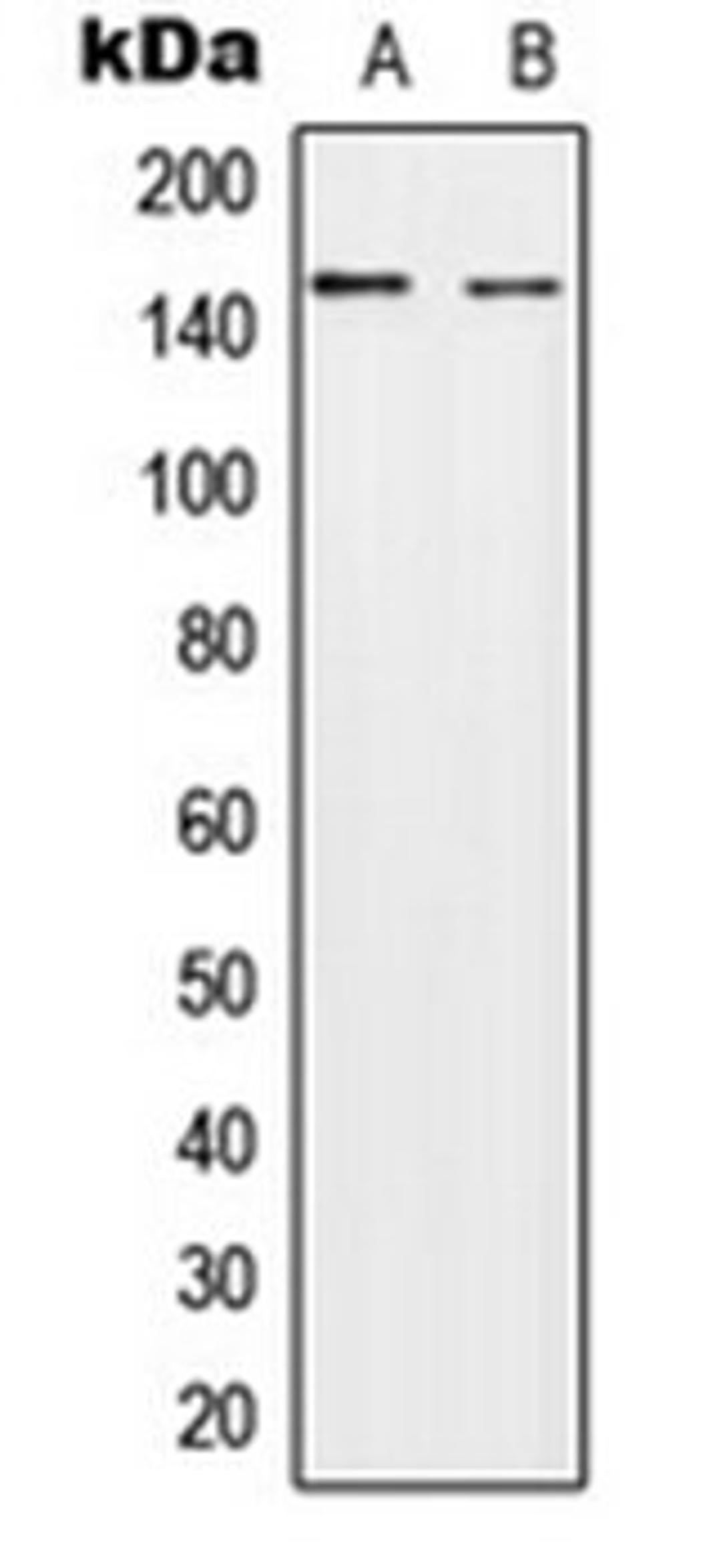 Western blot analysis of A549 (Lane 1), NIH3T3 (Lane 2) whole cell lysates using HECW2 antibody