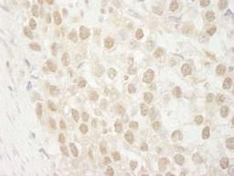 Detection of human MTA3 by immunohistochemistry.