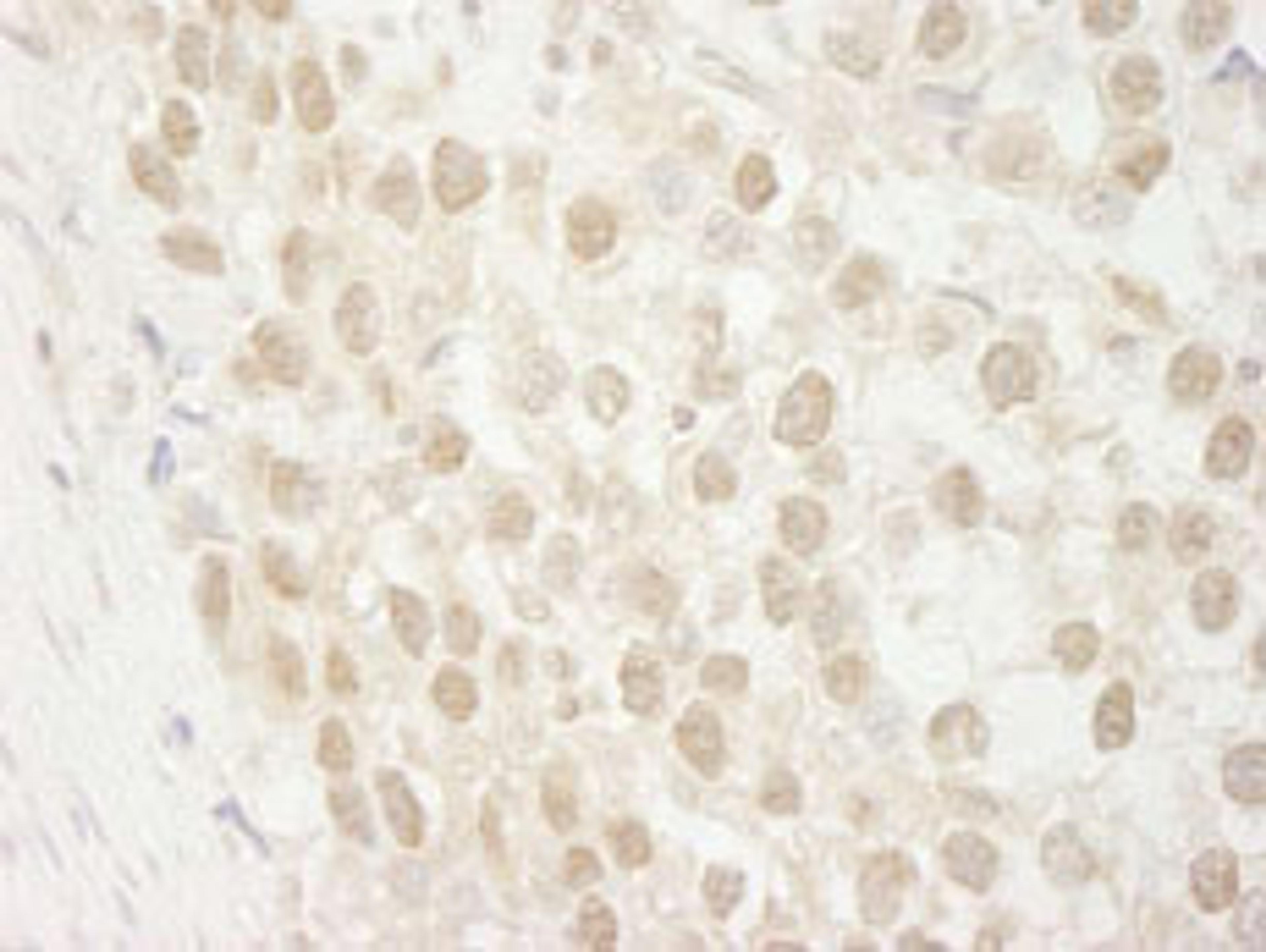 Detection of human MTA3 by immunohistochemistry.