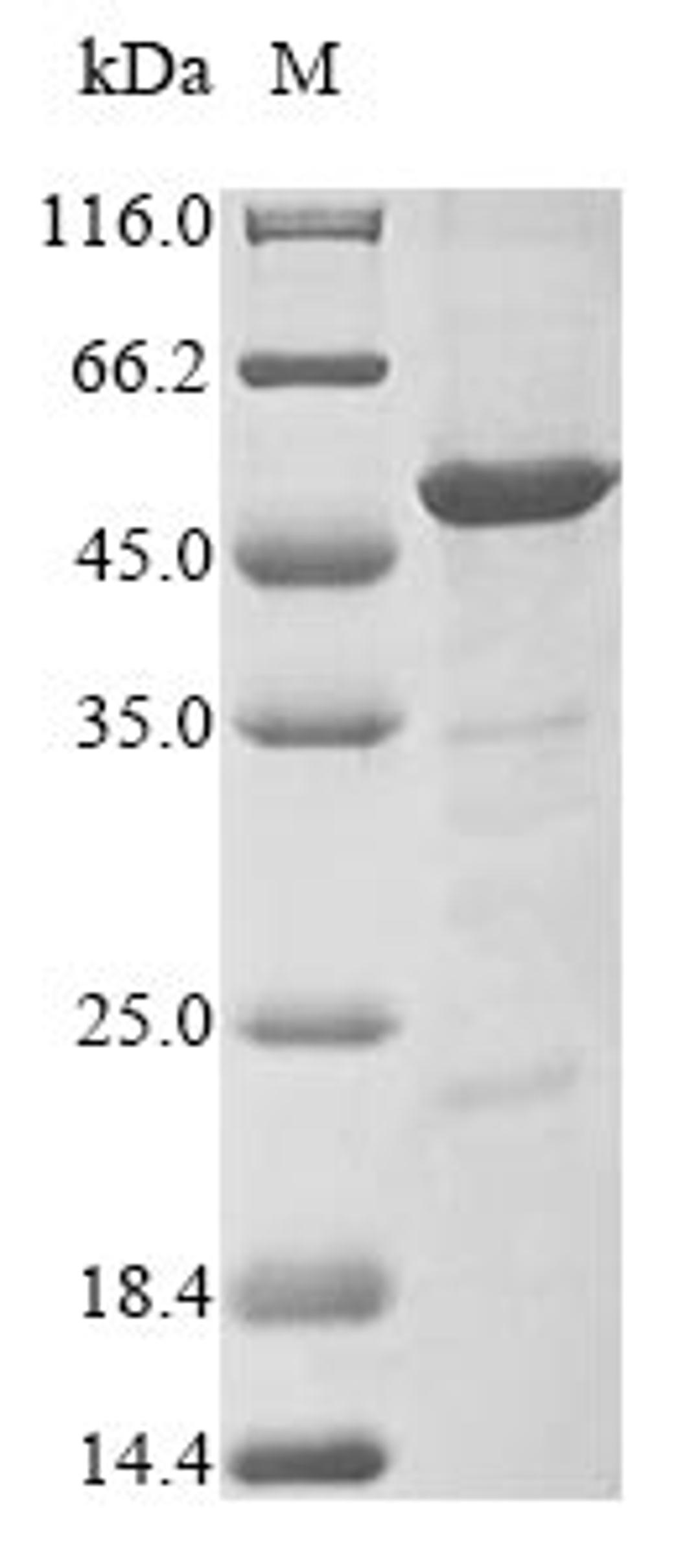 (Tris-Glycine gel) Discontinuous SDS-PAGE (reduced) with 5% enrichment gel and 15% separation gel.