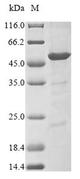 (Tris-Glycine gel) Discontinuous SDS-PAGE (reduced) with 5% enrichment gel and 15% separation gel.