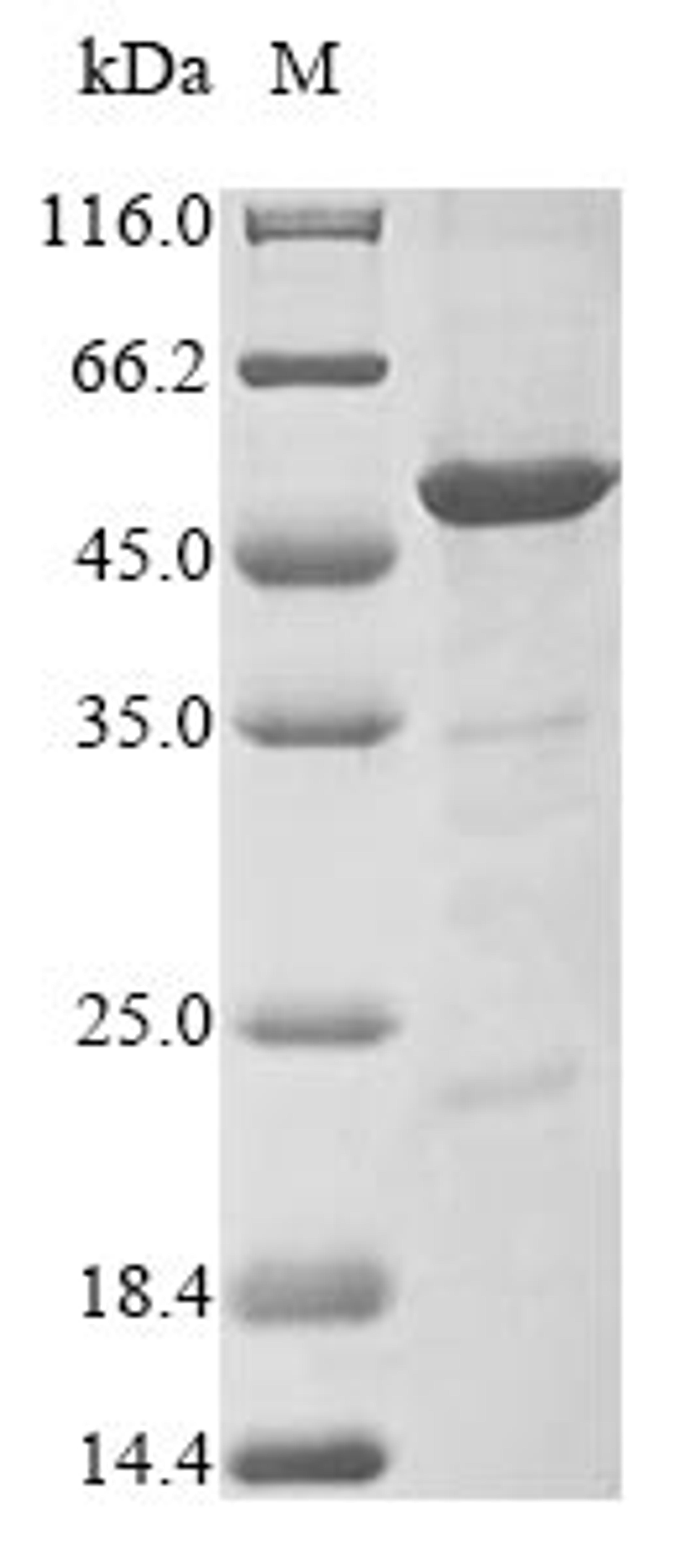 (Tris-Glycine gel) Discontinuous SDS-PAGE (reduced) with 5% enrichment gel and 15% separation gel.