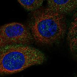 Immunocytochemistry/Immunofluorescence: USP49 Antibody [NBP1-81173] - Staining of human cell line A-431 shows positivity in nucleus & cytoplasm.