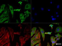 Immunocytochemistry/Immunofluorescence: SREBP2 Antibody (1D2) [NBP1-54446] - SREBP2 (1D2) antibody was tested in HeLa cells with DyLight 488 (green). Nuclei and alpha-tubulin were counterstained with DAPI (blue) and Dylight 550 (red).