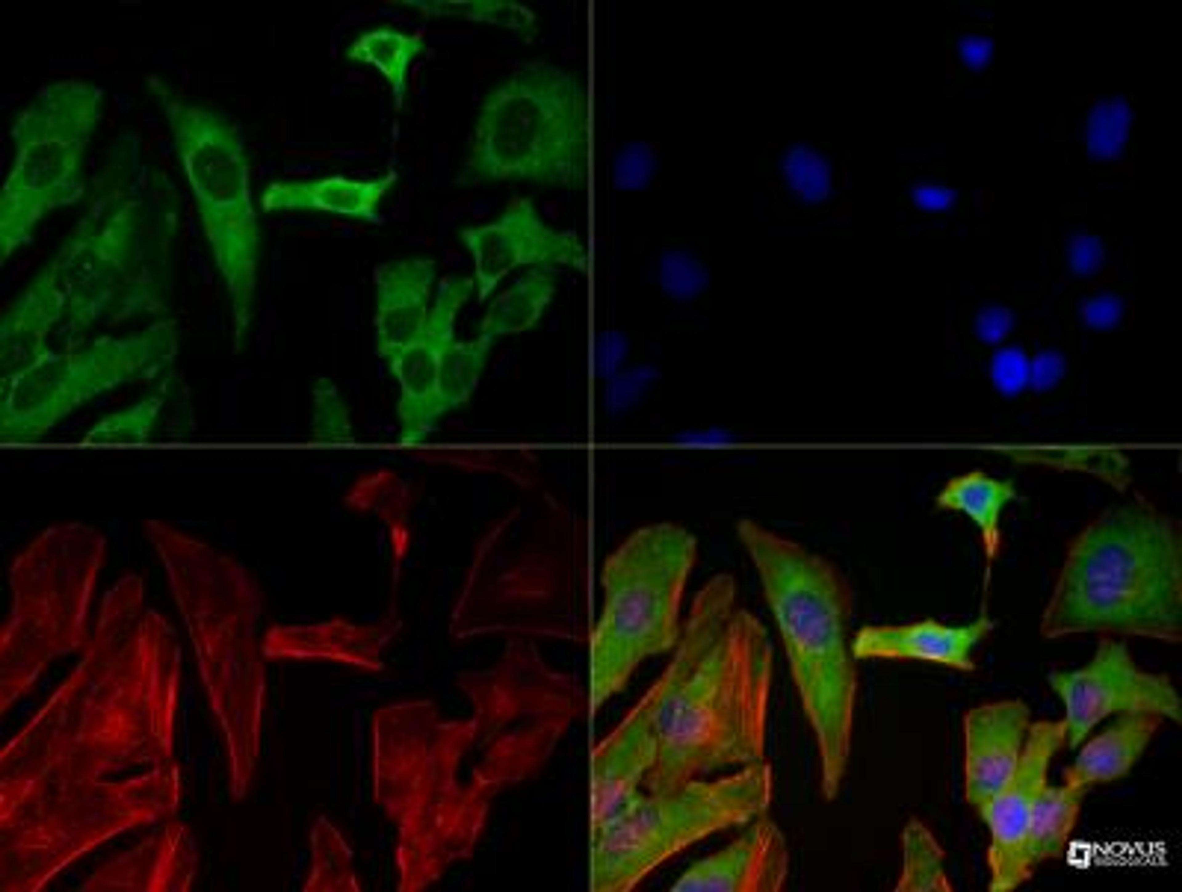 Immunocytochemistry/Immunofluorescence: SREBP2 Antibody (1D2) [NBP1-54446] - SREBP2 (1D2) antibody was tested in HeLa cells with DyLight 488 (green). Nuclei and alpha-tubulin were counterstained with DAPI (blue) and Dylight 550 (red).