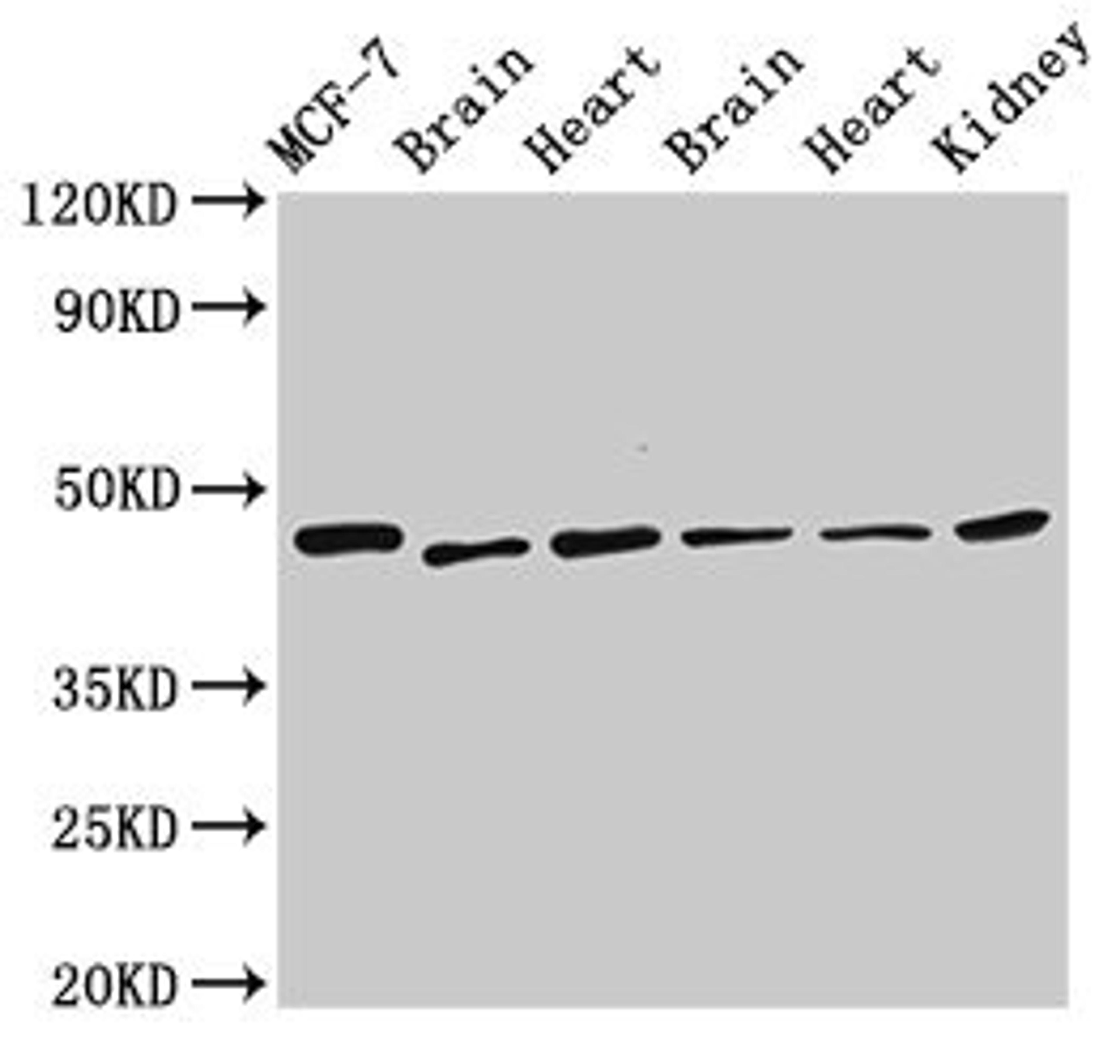 Western Blot. Positive WB detected in: MCF-7 whole cell lysate, Rat brain tissue, Rat heart tissue, Mouse brain tissue, Mouse heart tissue, Mouse kidney tissue. All lanes: DKC1 antibody at 2.5µg/ml. Secondary. Goat polyclonal to rabbit IgG at 1/50000 dilution. Predicted band size: 58, 48 kDa. Observed band size: 48 kDa