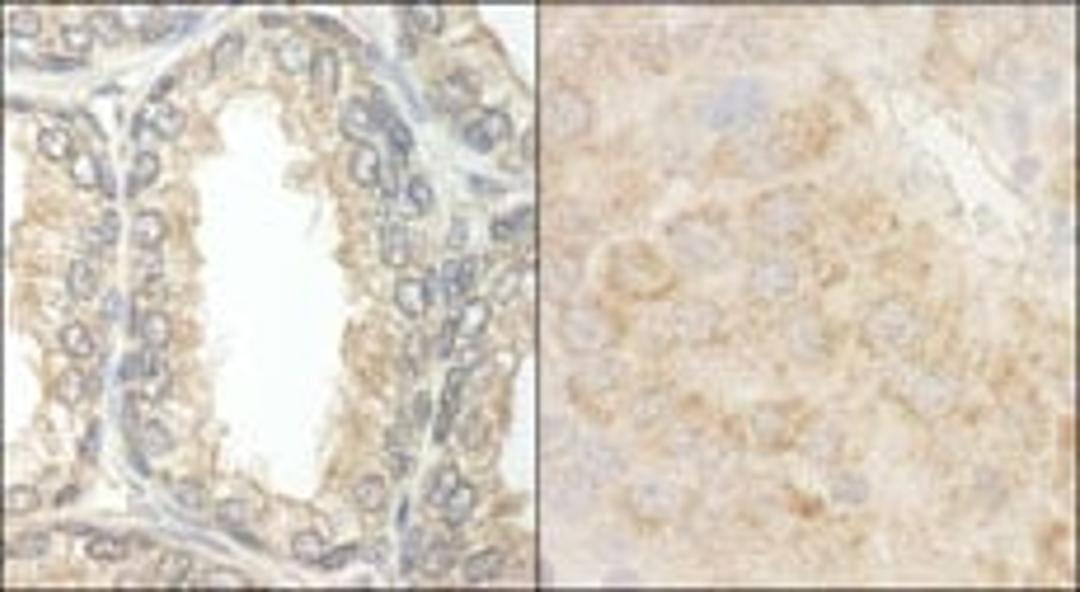 Detection of human and mouse BAD by immunohistochemistry.