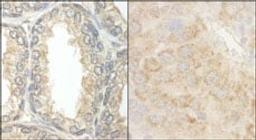 Detection of human and mouse BAD by immunohistochemistry.