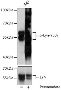 Western blot - Phospho-Lyn-Y507 antibody (AP0855)