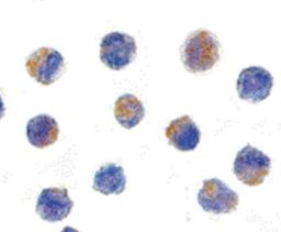 Immunohistochemistry: TXNDC12 Antibody [NBP1-52446] - K562 cells.