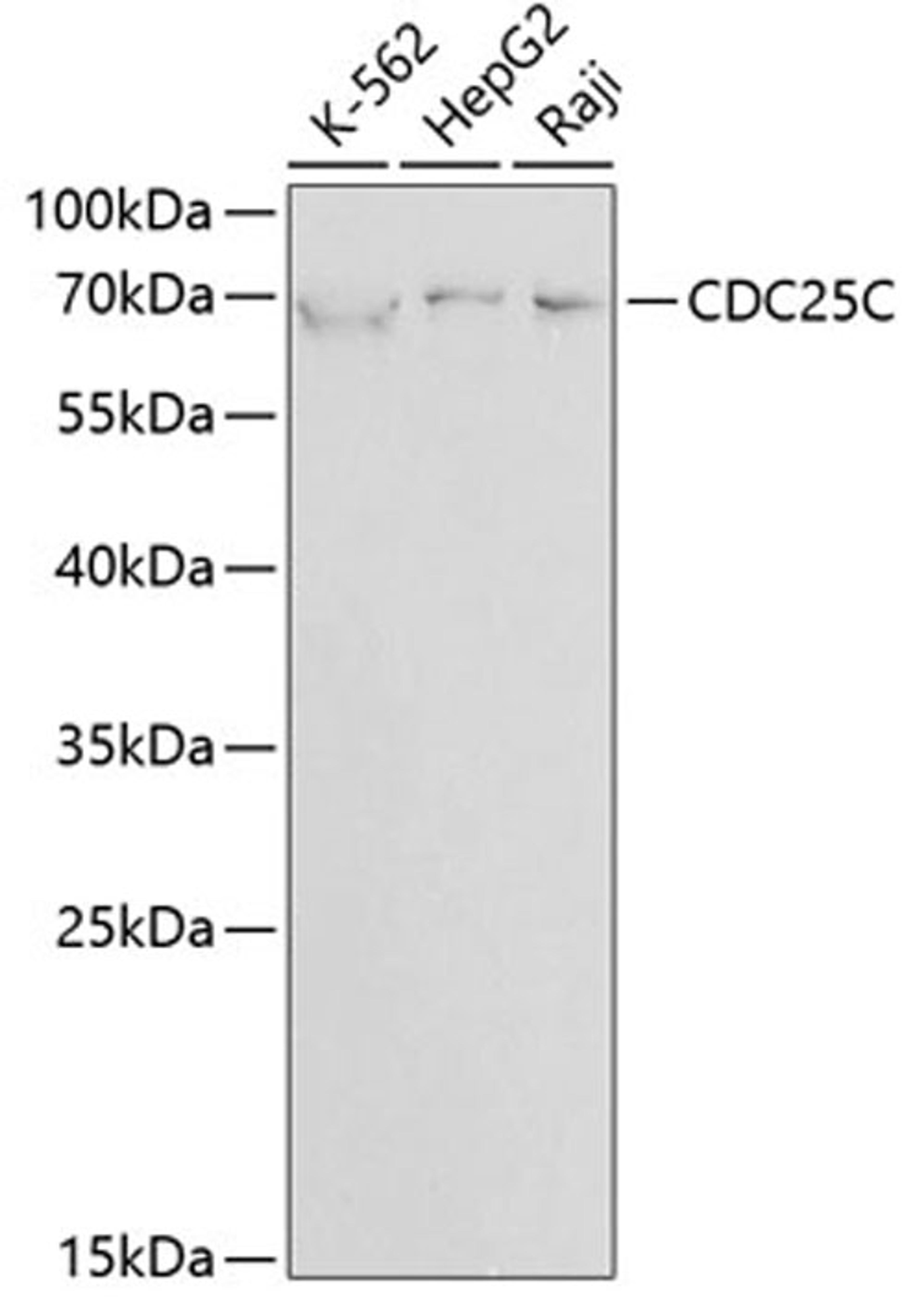 Western blot - CDC25C antibody (A1672)