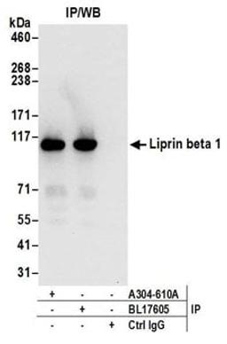 Detection of human Liprin beta 1 by western blot of immunoprecipitates.