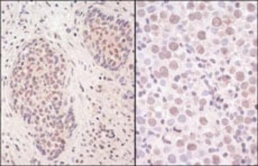 Detection of human SmcHD1 by immunohistochemistry.