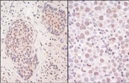 Detection of human SmcHD1 by immunohistochemistry.