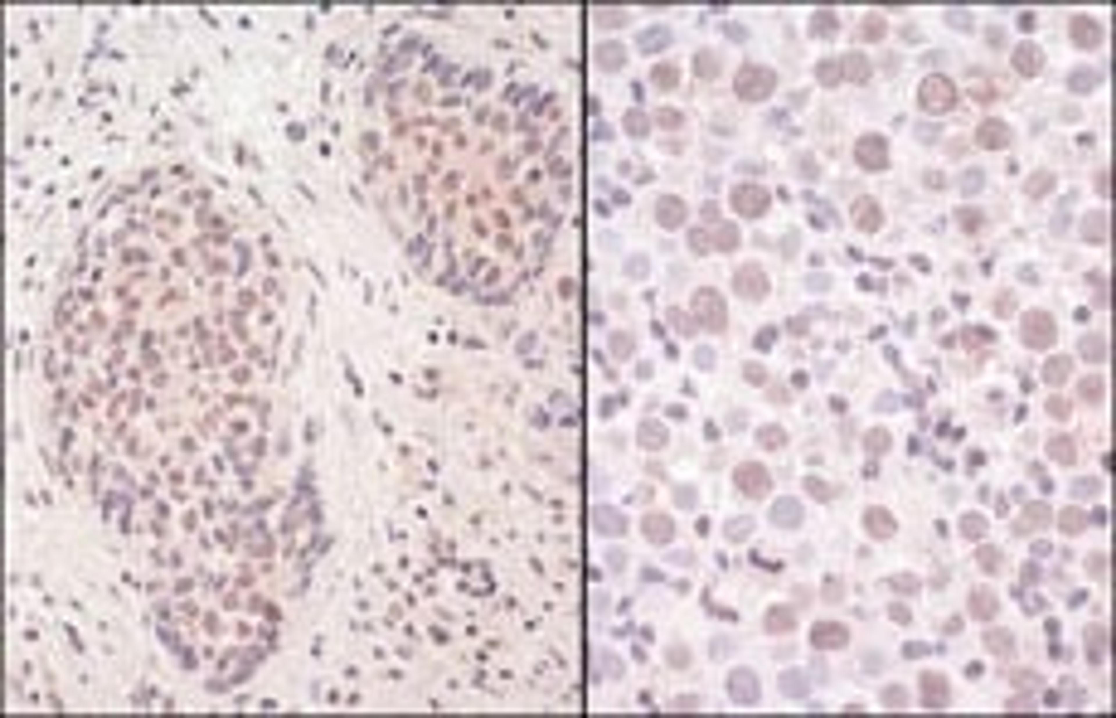 Detection of human SmcHD1 by immunohistochemistry.