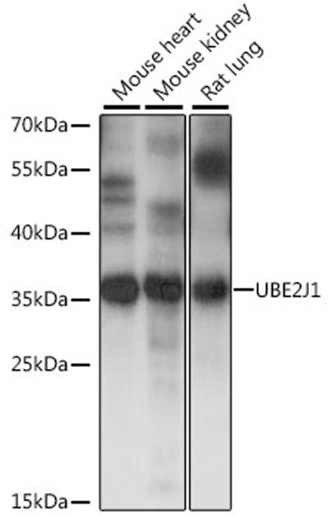 Western blot - UBE2J1 antibody (A15841)