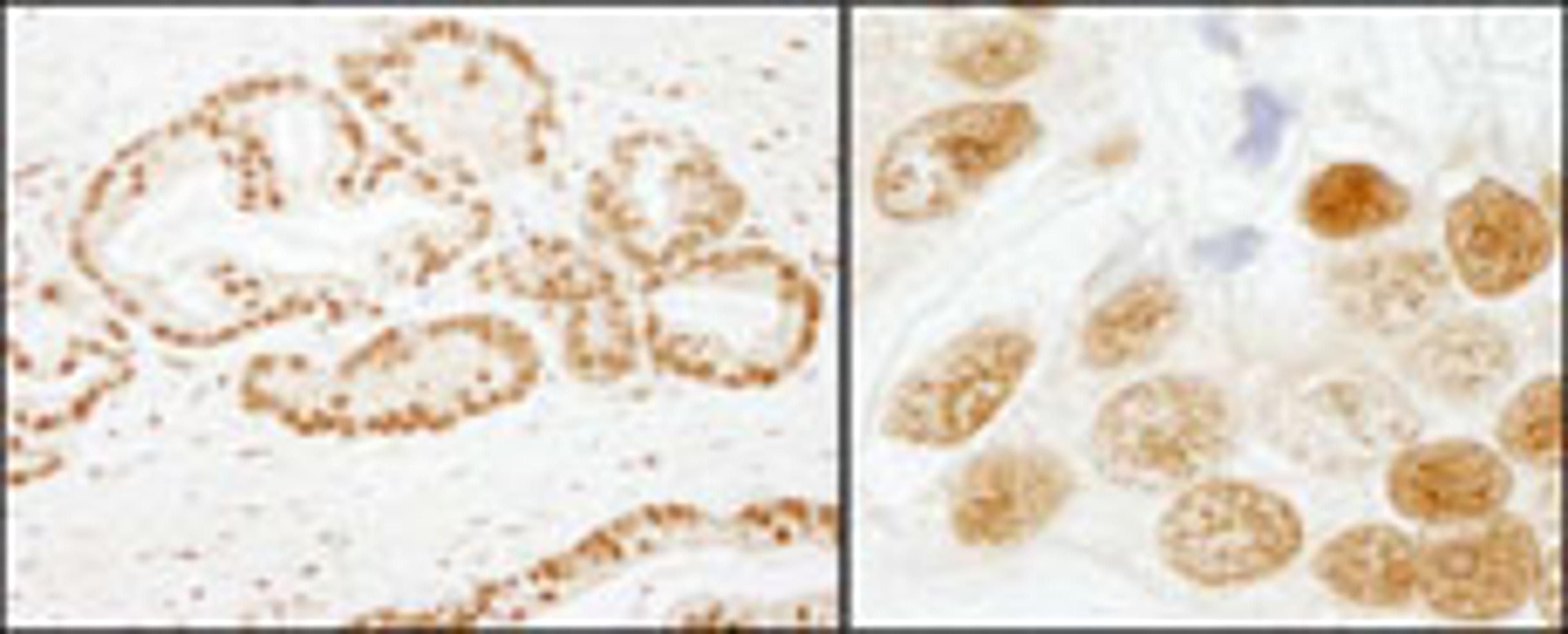 Detection of human SF3b155/SAP155 by immunohistochemistry.