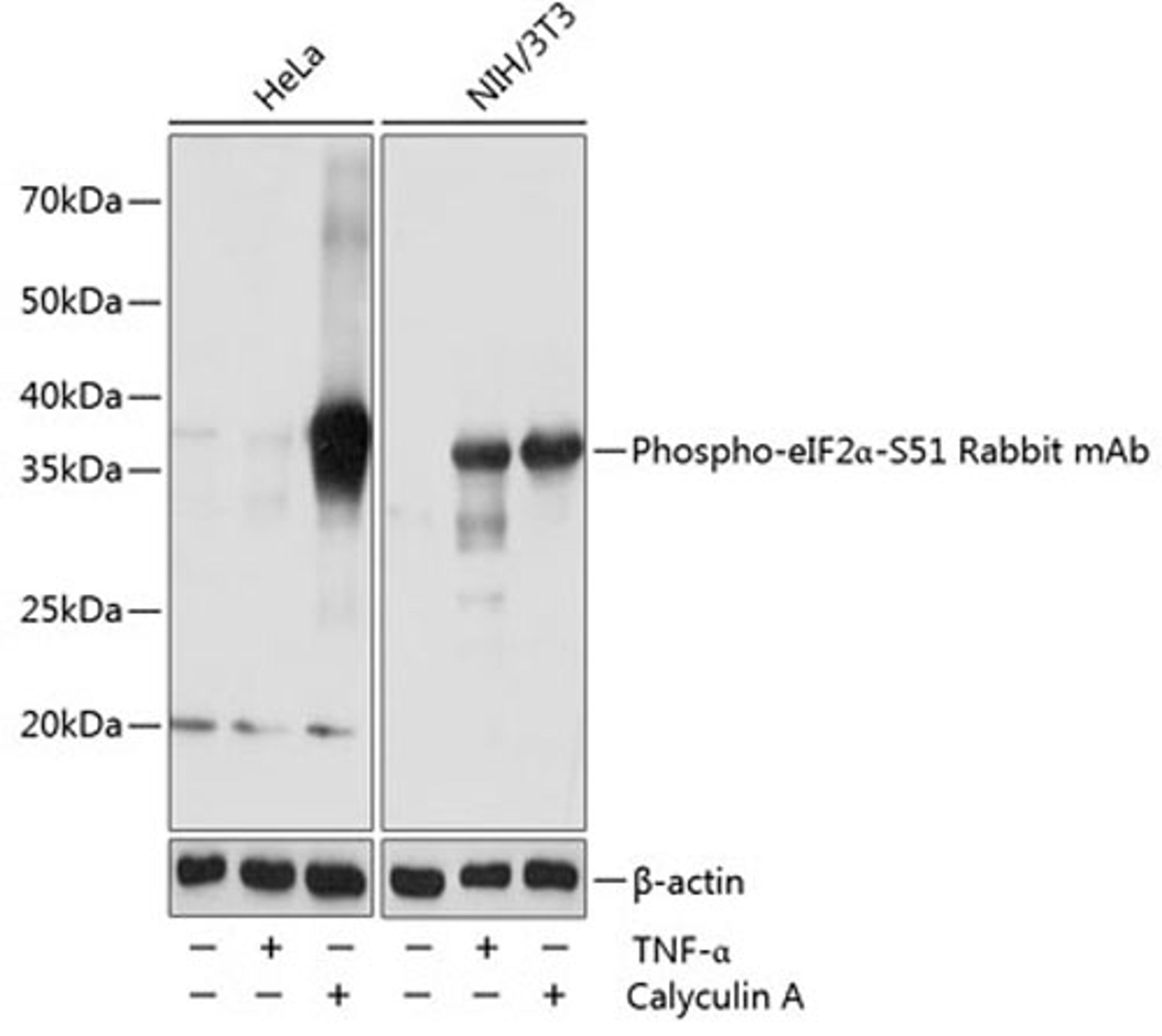 Western blot - Phospho-eIF2a-S51 Rabbit mAb (AP0692)