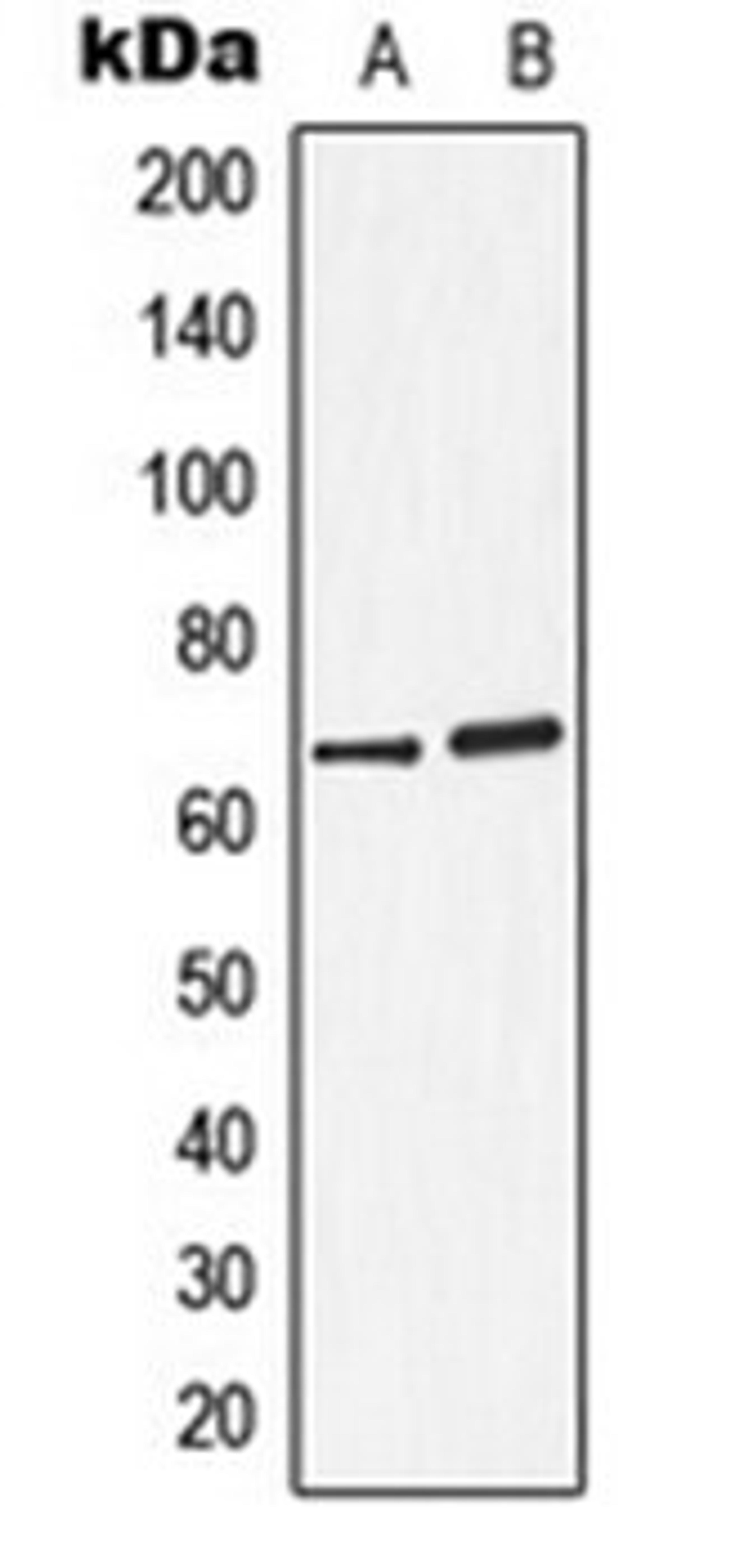 Western blot analysis of A549 (Lane 1), ZR751 (Lane 2) whole cell lysates using ARSD antibody