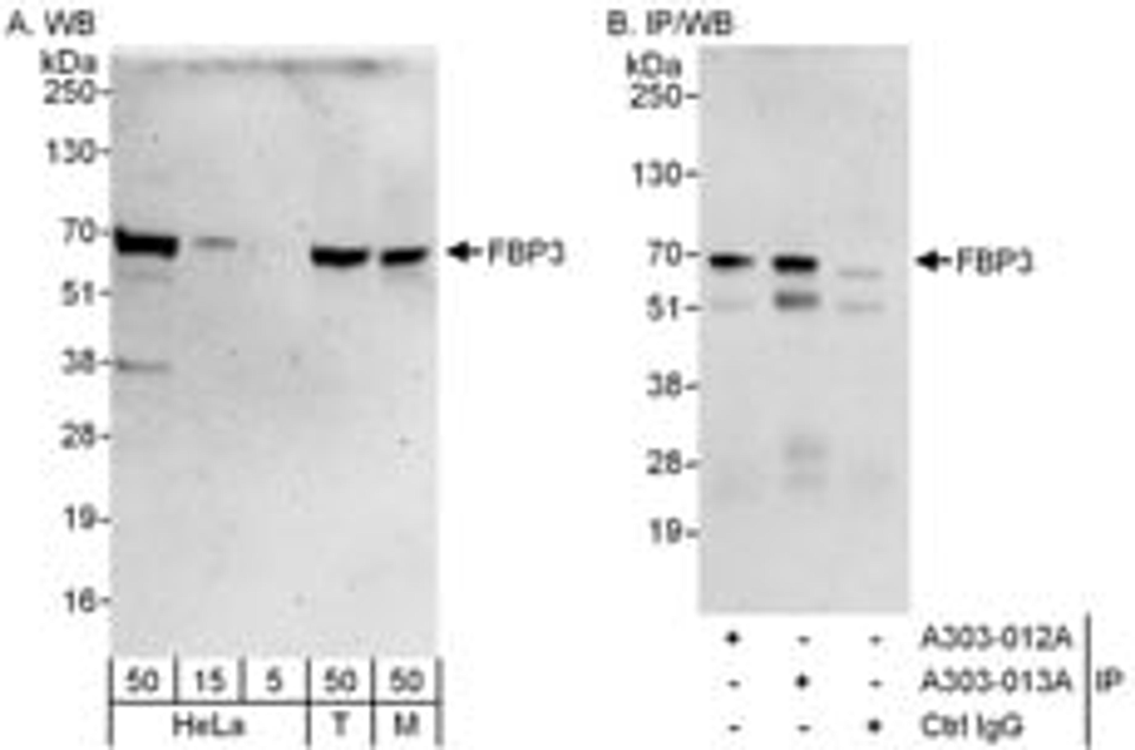 Detection of human and mouse FBP3 by western blot (h&m) and immunoprecipitation (h).