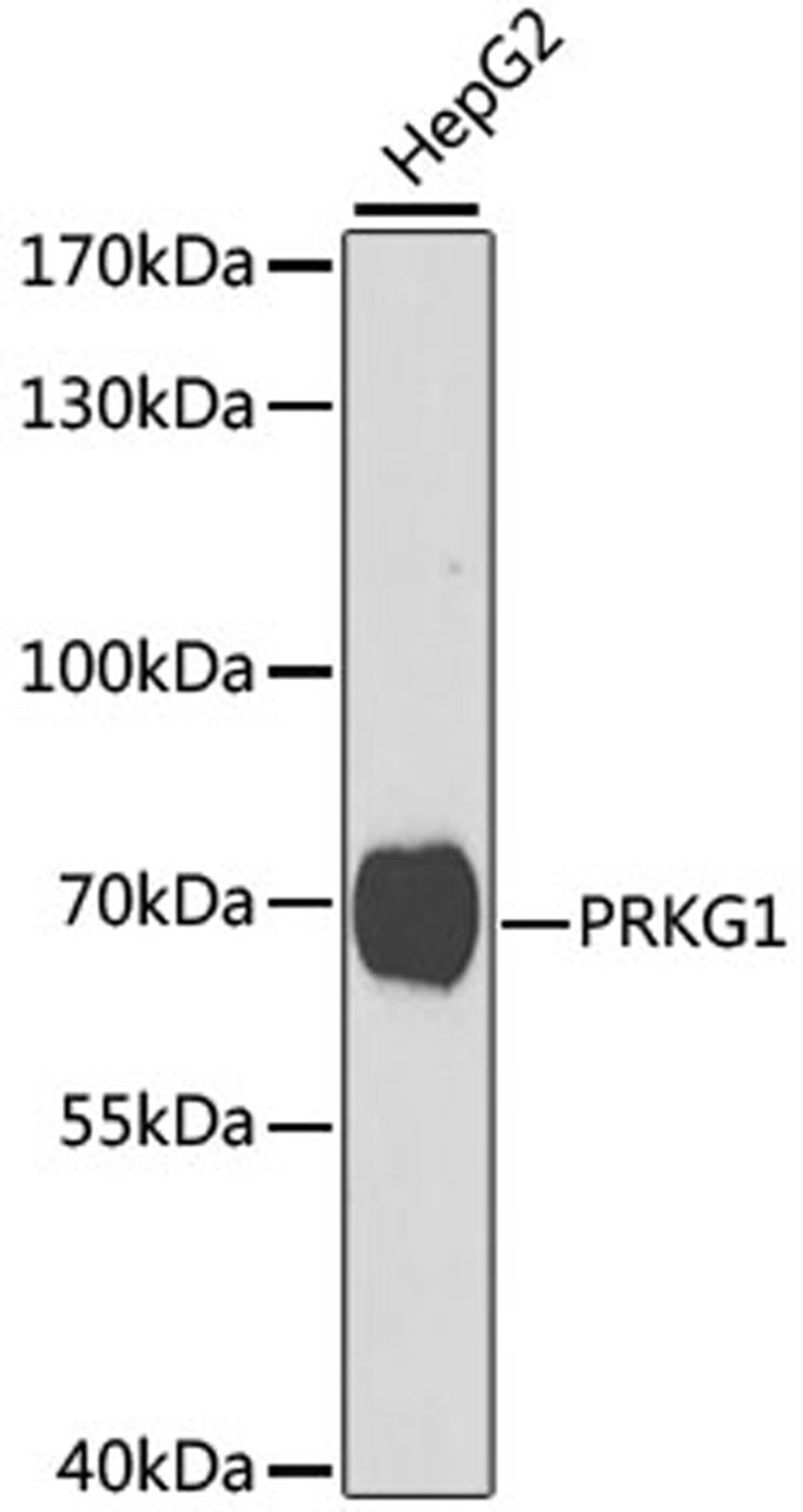 Western blot - PRKG1 antibody (A2565)