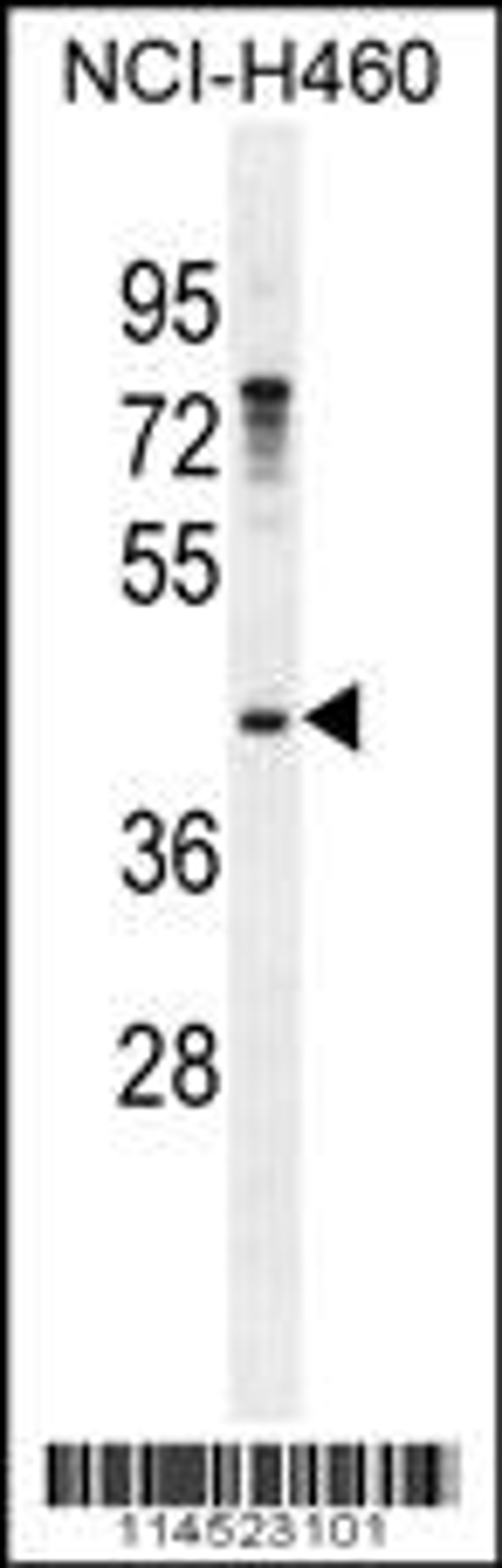 Western blot analysis in NCI-H460 cell line lysates (35ug/lane).