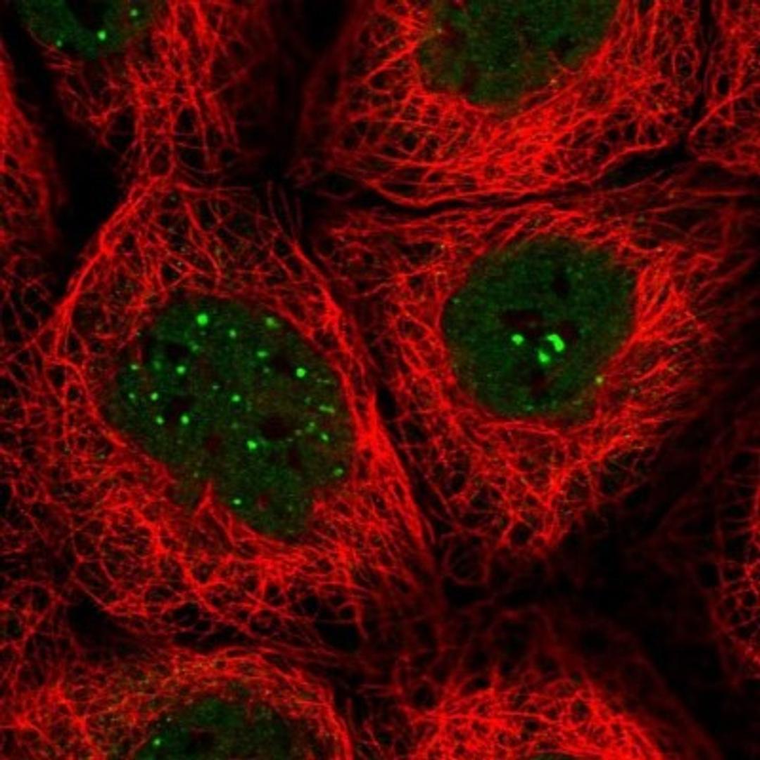 Immunocytochemistry/Immunofluorescence: C1orf56 Antibody [NBP2-32683] - Immunofluorescent staining of human cell line A-431 shows positivity in nucleus but not nucleoli. Antibody staining is shown in green.