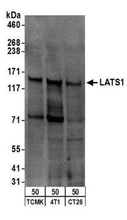 Detection of mouse LATS1 by western blot.