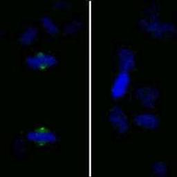 Detection of human Phospho-Aurora A (T288) by immunocytochemistry.