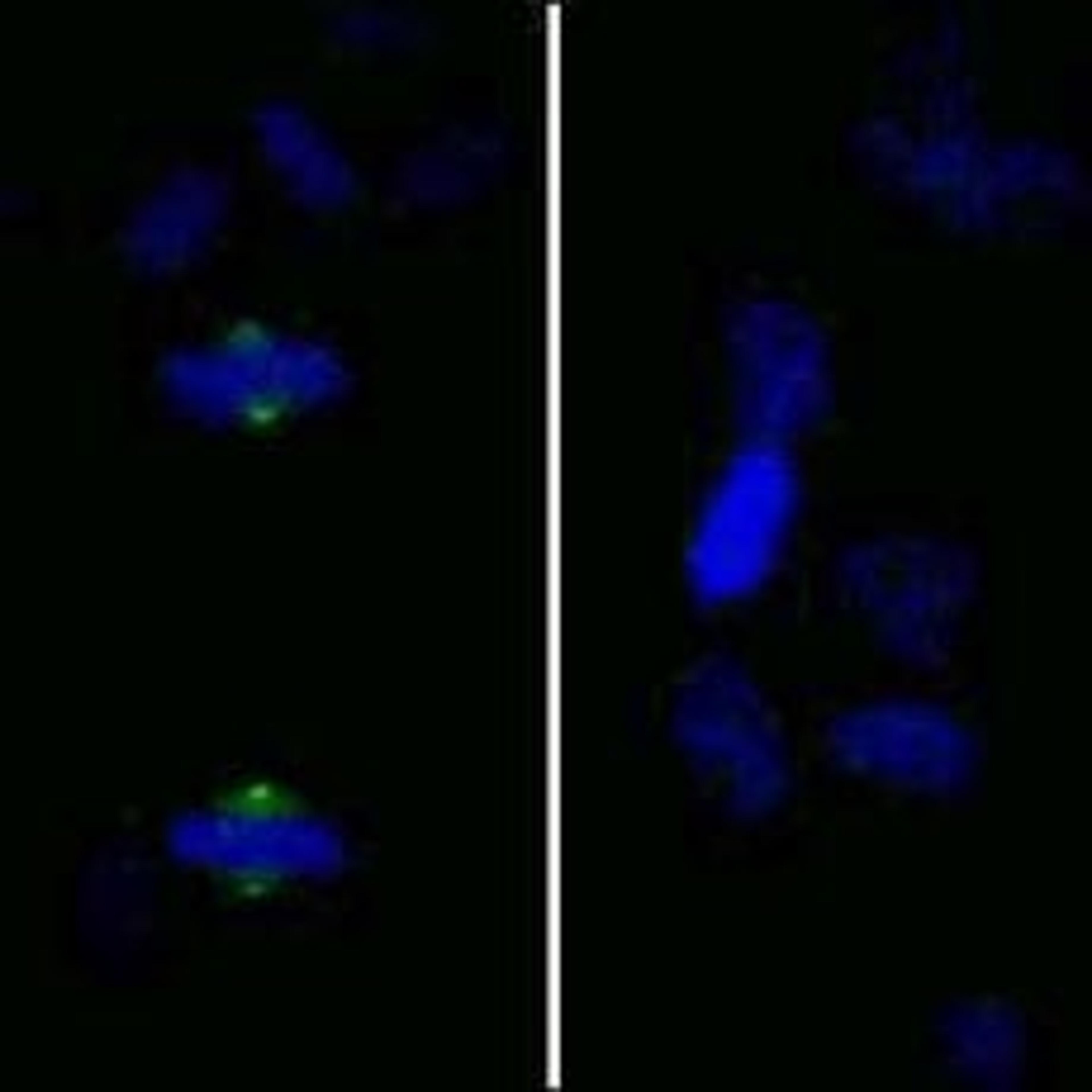 Detection of human Phospho-Aurora A (T288) by immunocytochemistry.