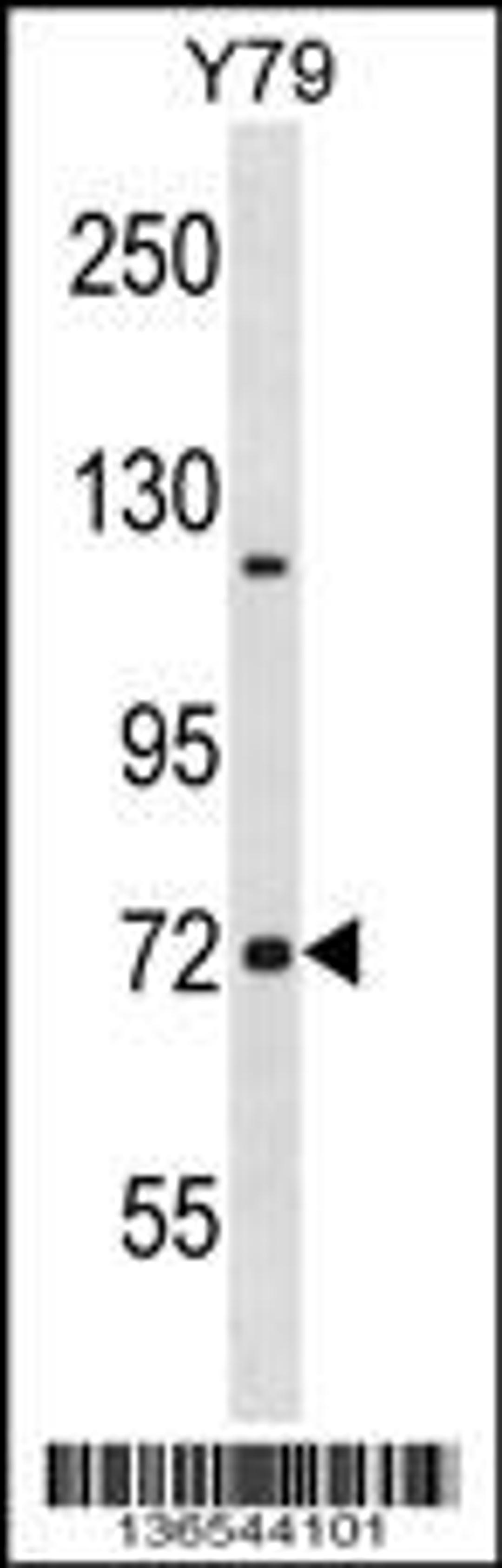 Western blot analysis in Y79 cell line lysates (35ug/lane).