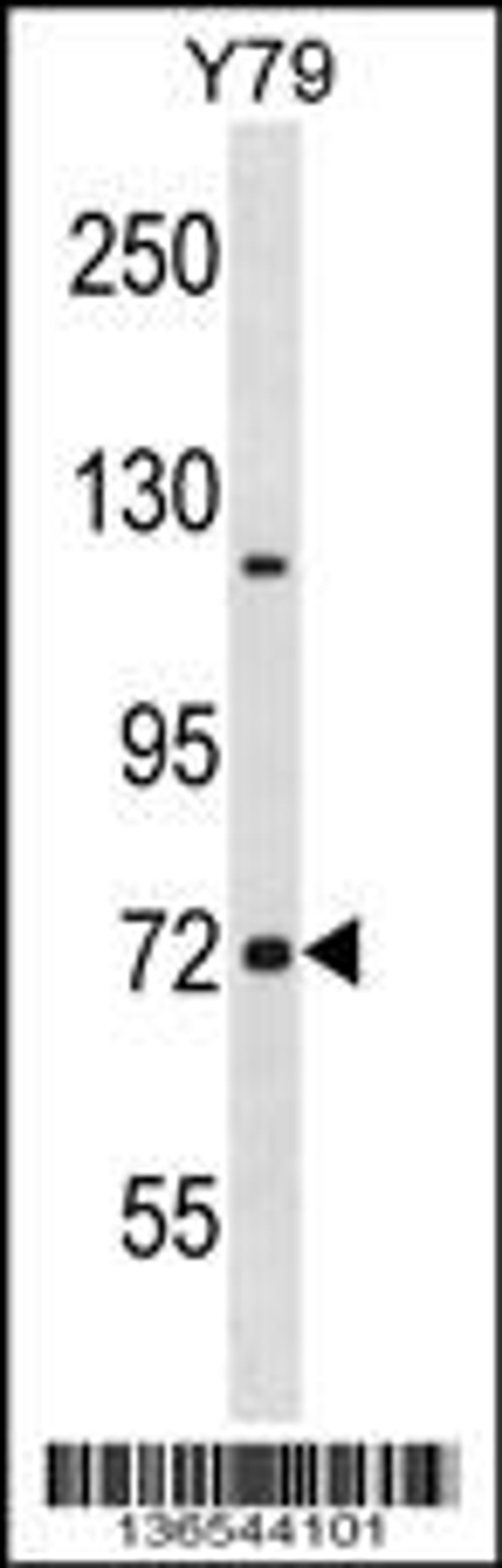 Western blot analysis in Y79 cell line lysates (35ug/lane).