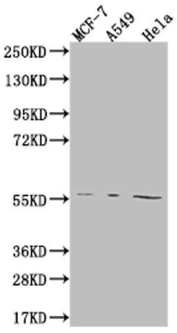 Western Blot. Positive WB detected in: MCF-7 whole cell lysate, A549 whole cell lysate, Hela whole cell lysate. All lanes: FADS1 antibody at 1:2000. Secondary. Goat polyclonal to rabbit IgG at 1/50000 dilution. Predicted band size: 52, 43 kDa. Observed band size: 55 kDa.