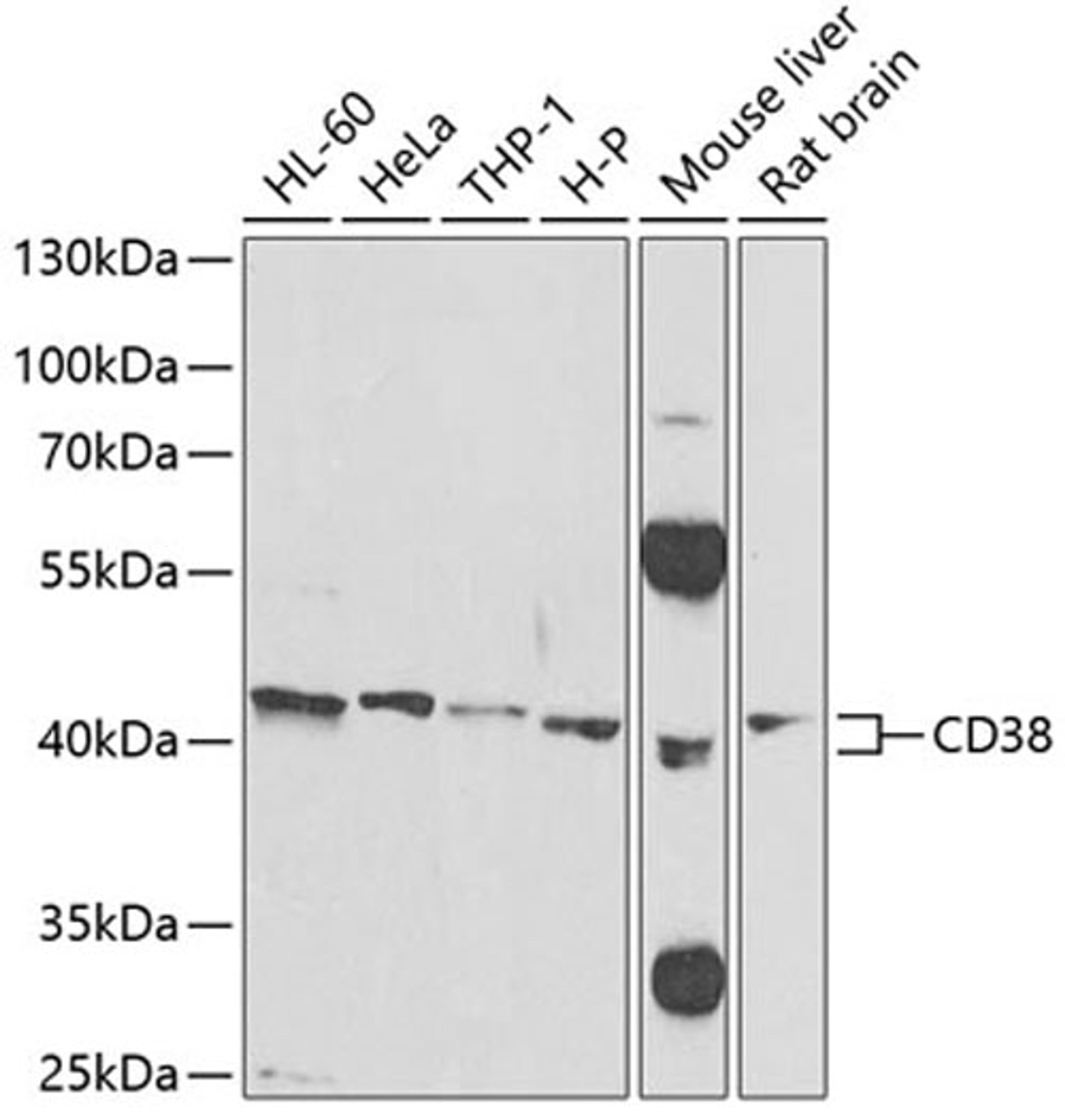 Western blot - CD38 Antibody (A1680)