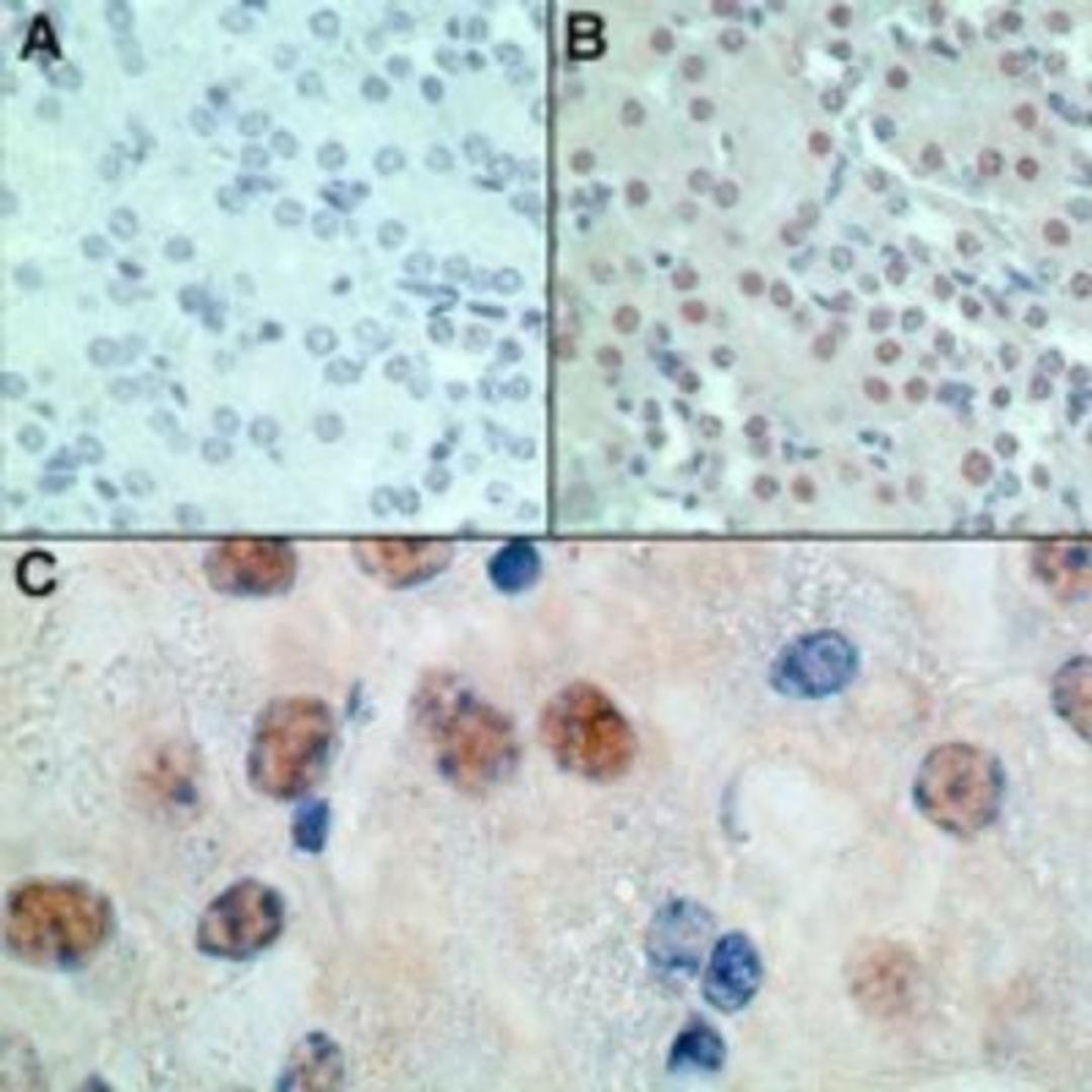 Immunohistochemistry-Paraffin: MSX1 Antibody [NBP2-24715] - Analysis of HOX7 expression in formalin-fixed, paraffin embedded normal mouse liver tissue. A: Staining with rabbit IgG (isotype control) at 2.5 ug/ml. B: Staining with rabbit anti-HOX7 at 2.5 ug/ml. C: Higher magnification of B, showing nuclear expression of HOX7.