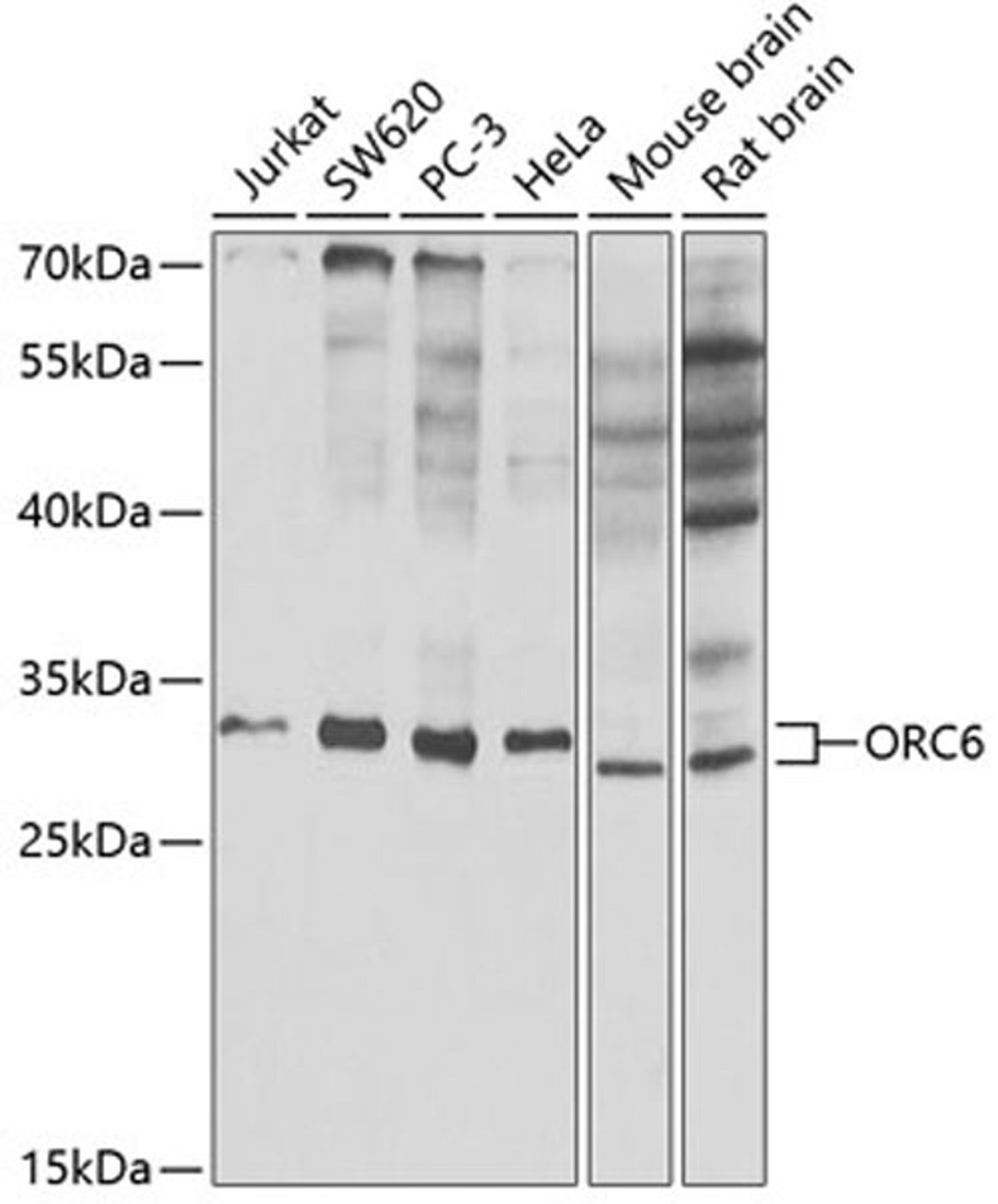 Western blot - ORC6 antibody (A5426)