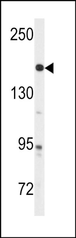 Western blot analysis of anti-ABL Antibody (Y251) in A2058 cell line lysates (35ug/lane)