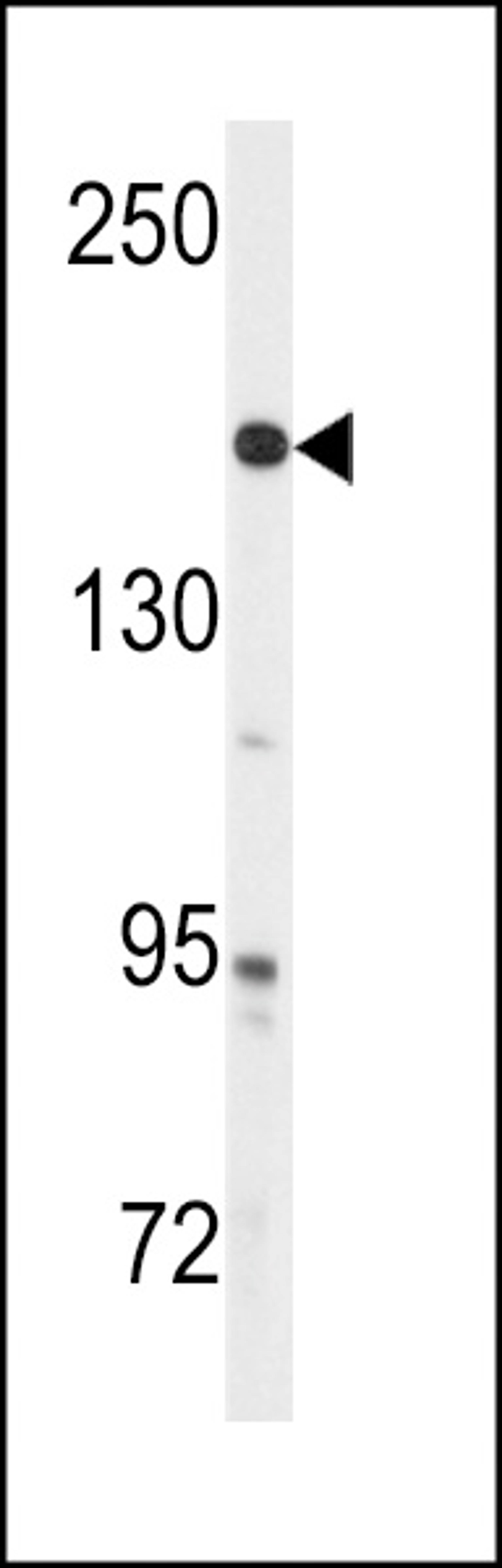 Western blot analysis of anti-ABL Antibody (Y251) in A2058 cell line lysates (35ug/lane)