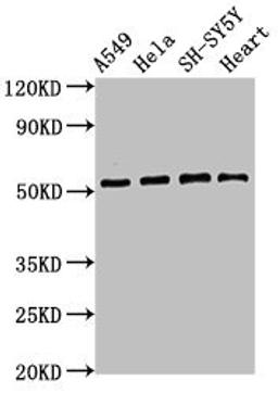 Western Blot. Positive WB detected in: A549 whole cell lysate, Hela whole cell lysate, SH-SY5Y whole cell lysate, Mouse heart tissue. All lanes: ATG4D antibody at 2.8µg/ml. Secondary. Goat polyclonal to rabbit IgG at 1/50000 dilution. Predicted band size: 53, 17 kDa. Observed band size: 53 kDa