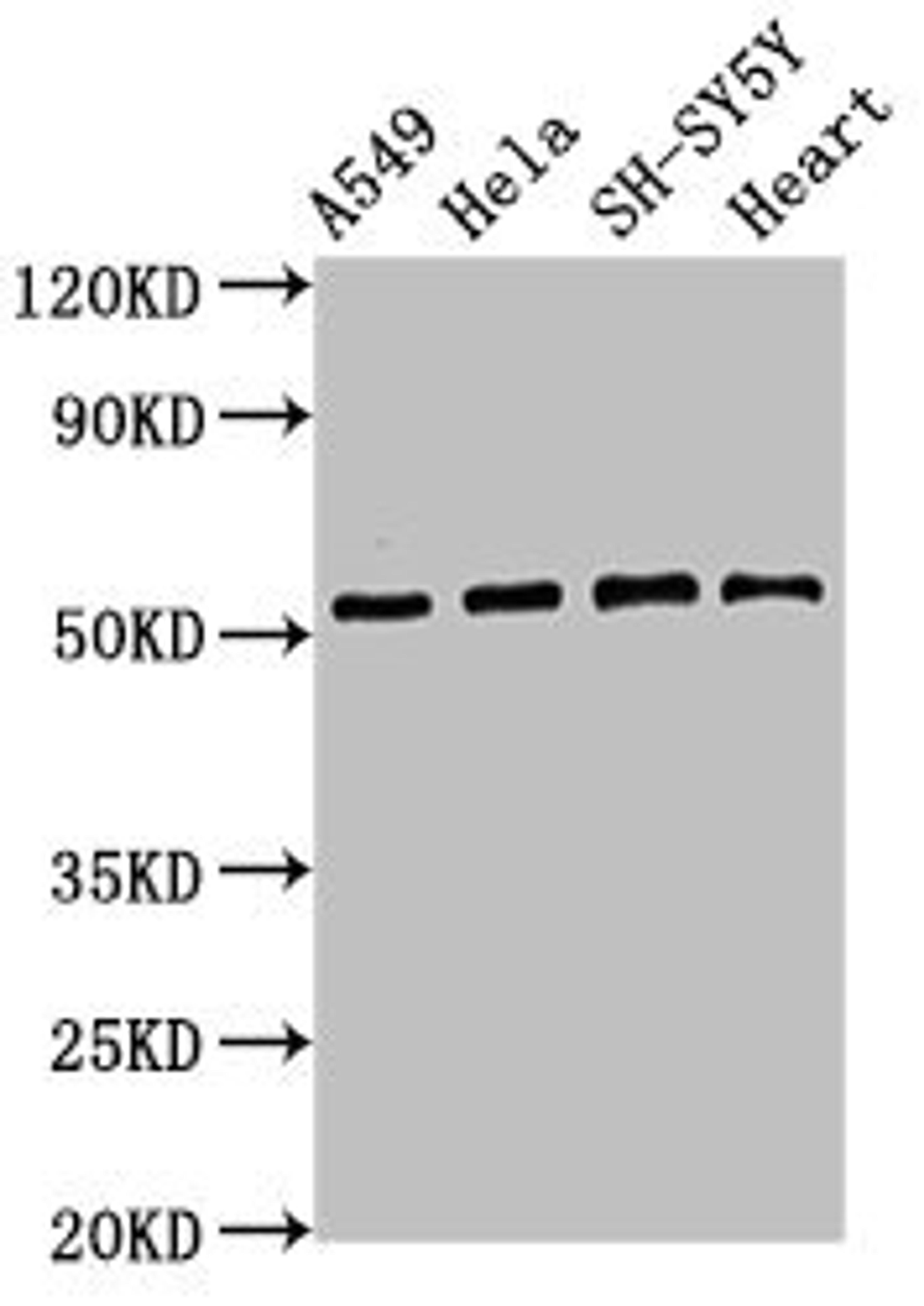 Western Blot. Positive WB detected in: A549 whole cell lysate, Hela whole cell lysate, SH-SY5Y whole cell lysate, Mouse heart tissue. All lanes: ATG4D antibody at 2.8µg/ml. Secondary. Goat polyclonal to rabbit IgG at 1/50000 dilution. Predicted band size: 53, 17 kDa. Observed band size: 53 kDa