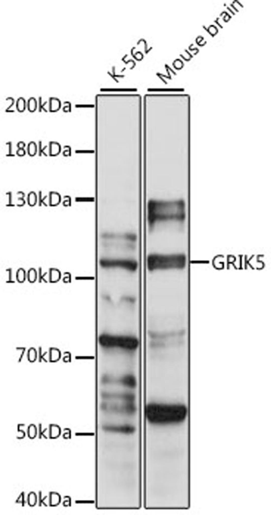 Western blot - GRIK5 antibody (A15676)