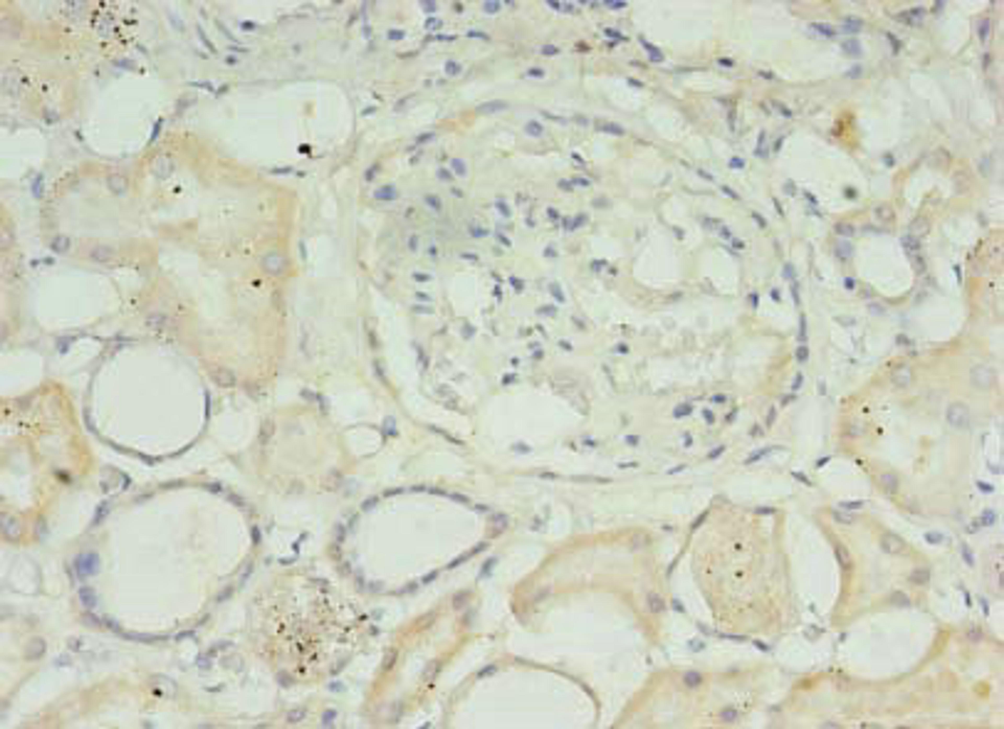 Immunohistochemistry of paraffin-embedded human kidney tissue using CSB-PA822225LA01HU at dilution of 1:100