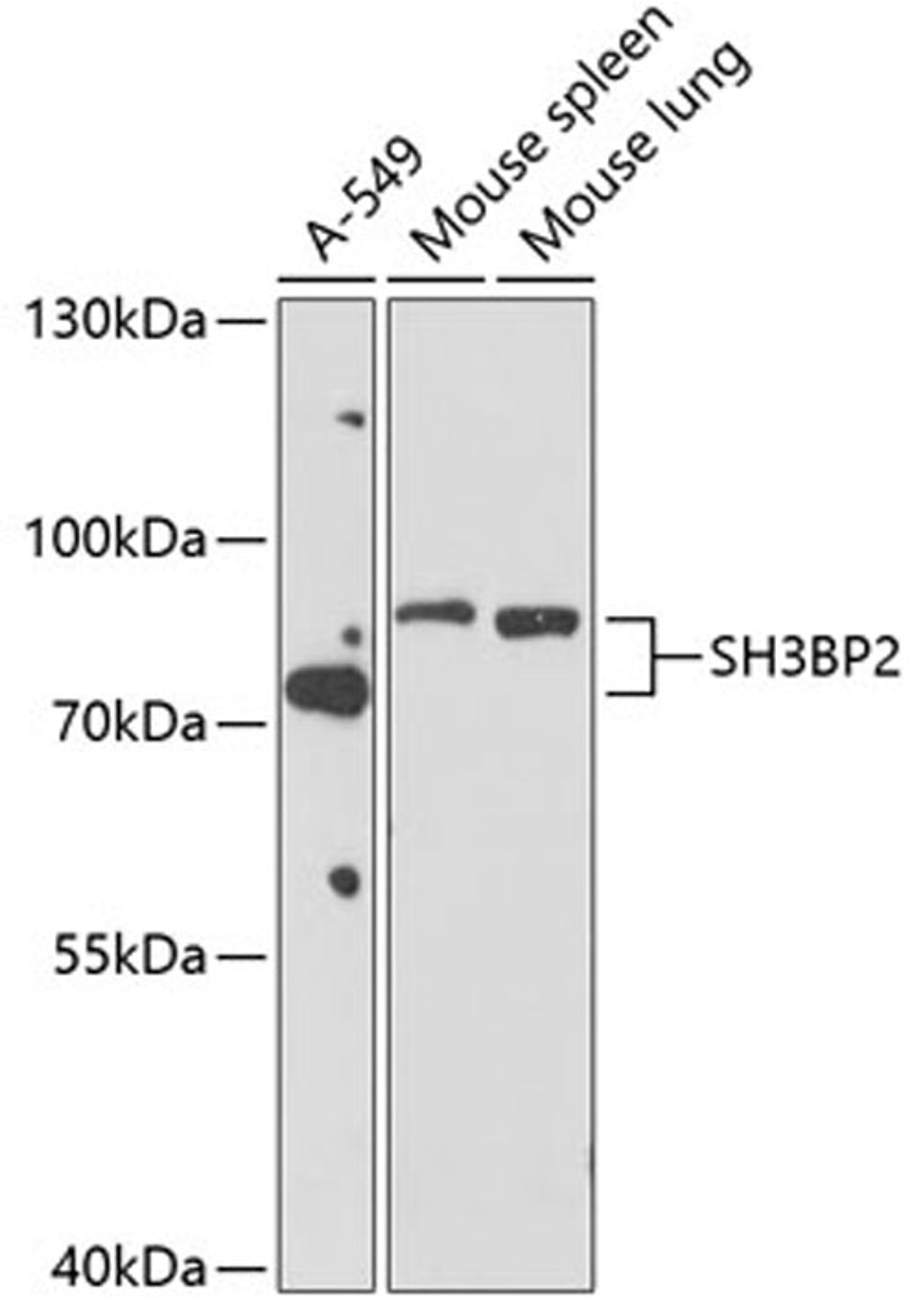 Western blot - SH3BP2 antibody (A10243)