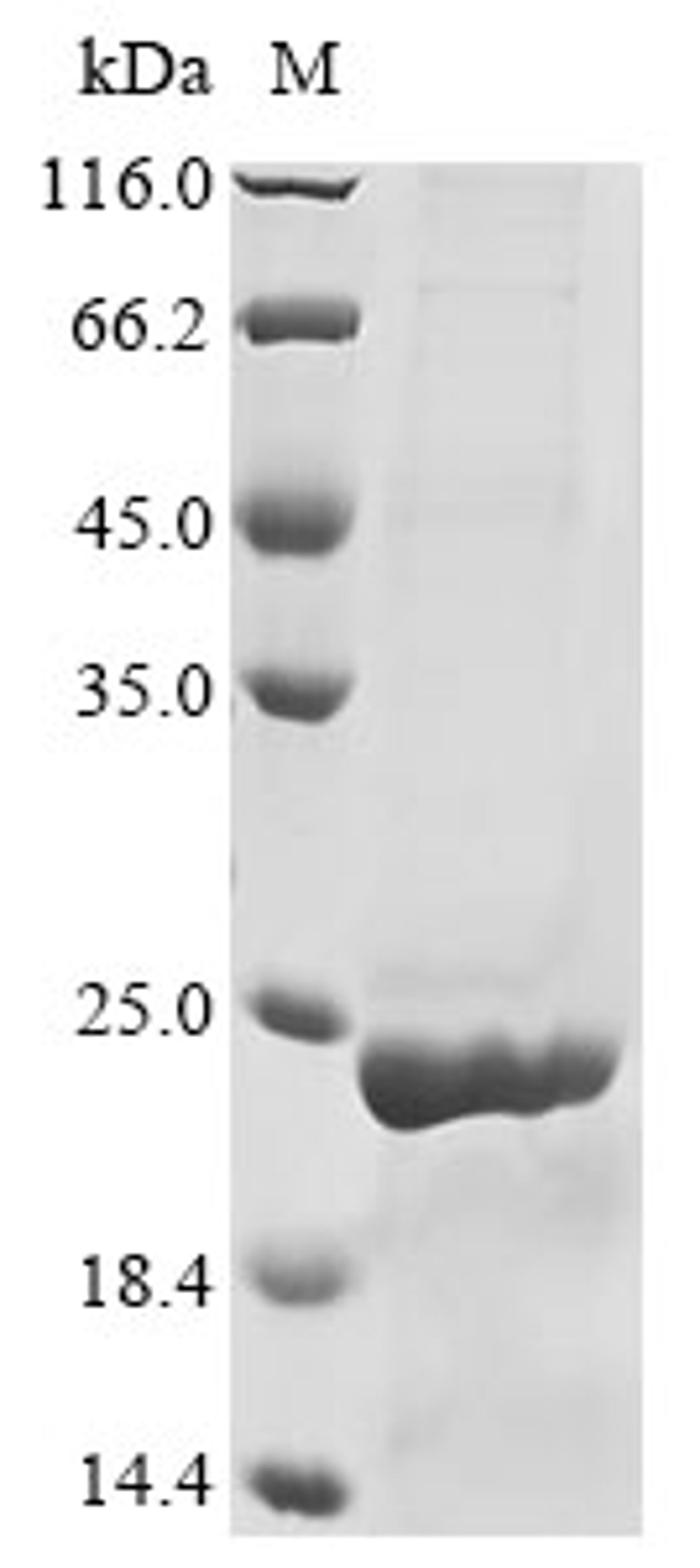 (Tris-Glycine gel) Discontinuous SDS-PAGE (reduced) with 5% enrichment gel and 15% separation gel.