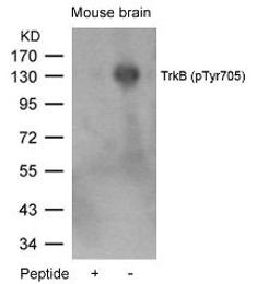 Western blot analysis of lysed extracts from mouse brain tissue using TrkB (Phospho-Tyr705).