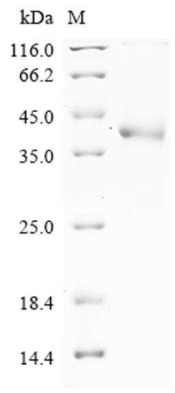 (Tris-Glycine gel) Discontinuous SDS-PAGE (reduced) with 5% enrichment gel and 15% separation gel.