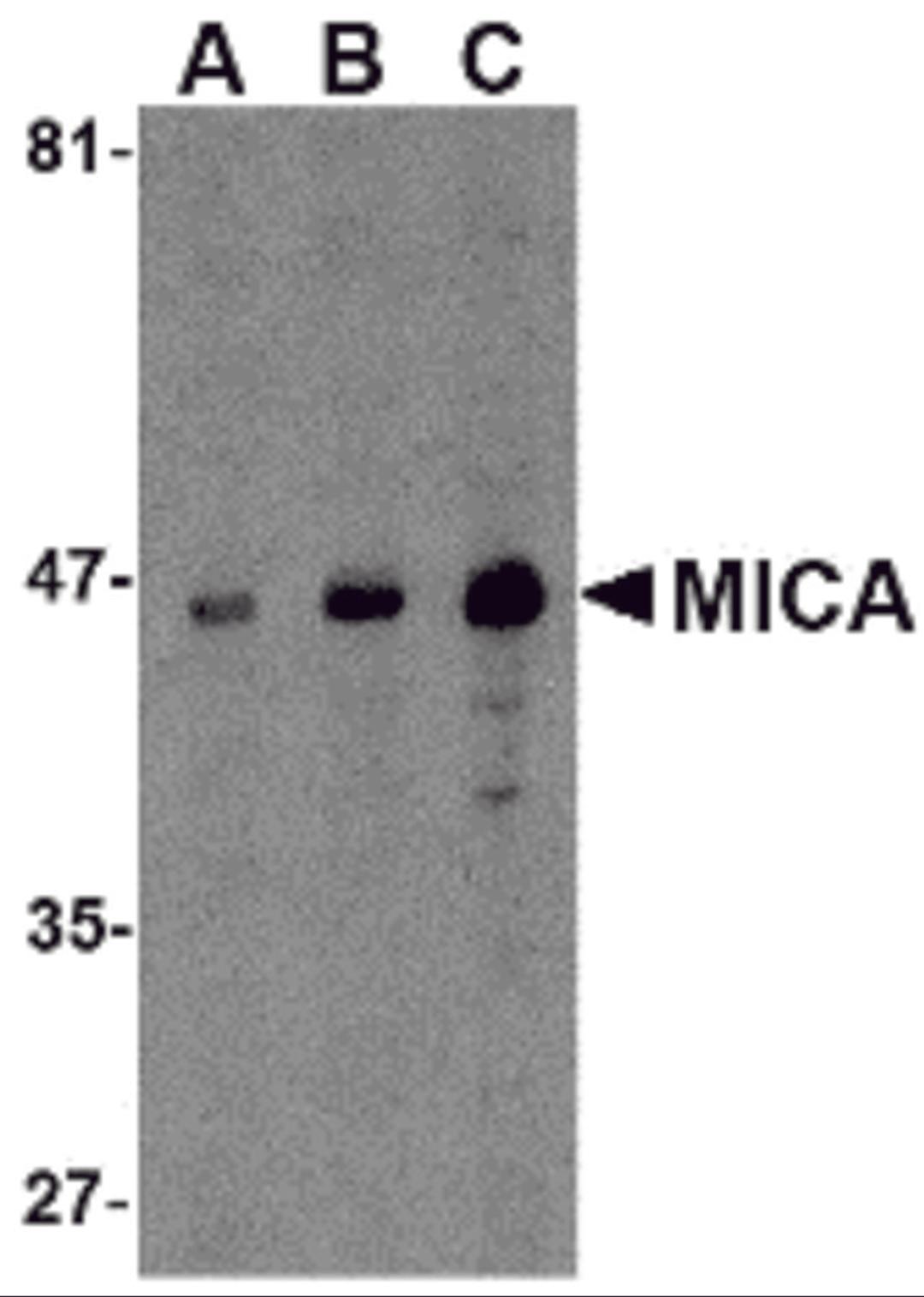 Western blot analysis of MICA in A-20 cell lysate with MICA antibody at (A) 0.5, (B) 1 and (C) 2 &#956;g/mL.