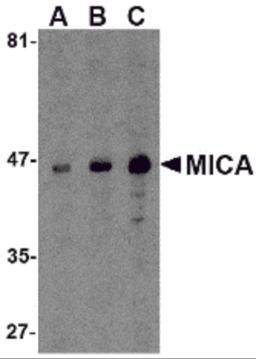 Western blot analysis of MICA in A-20 cell lysate with MICA antibody at (A) 0.5, (B) 1 and (C) 2 &#956;g/mL.